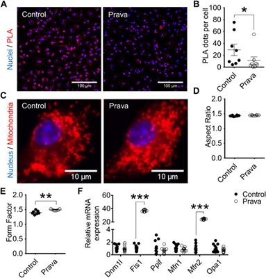 In Vivo Pravastatin Treatment Reverses Hypercholesterolemia Induced Mitochondria-Associated Membranes Contact Sites, Foam Cell Formation, and Phagocytosis in Macrophages